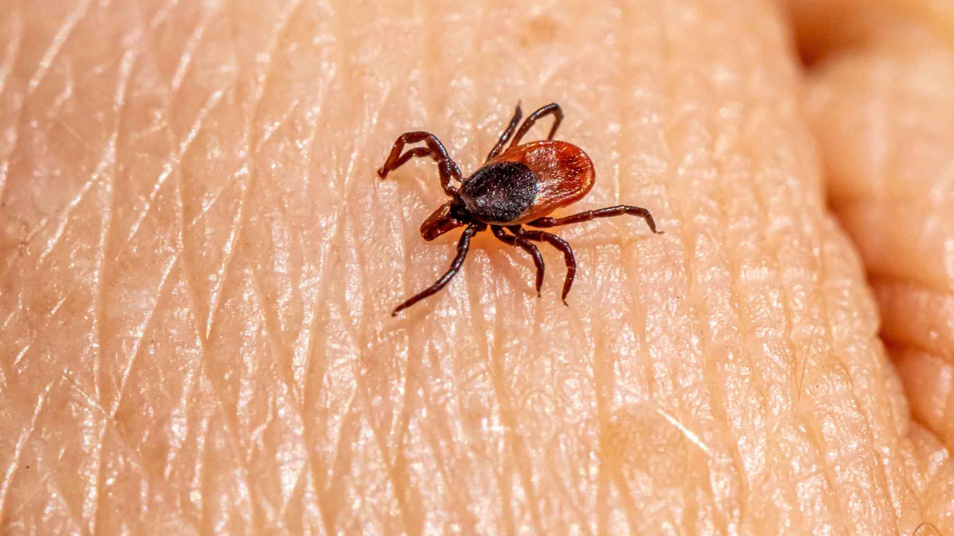 Lone star tick crawling on human skin causing meat allergy