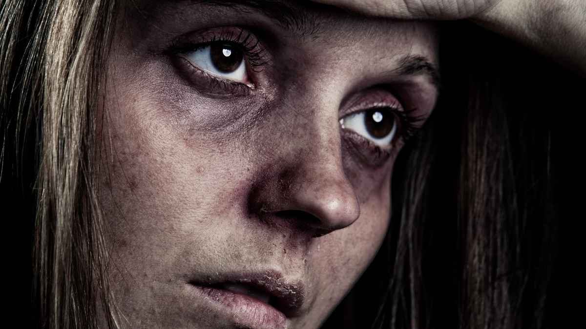 Mujer con rostro cansado y signos de agotamiento representando la dificultad de las bajas médicas y la incapacidad temporal en España.