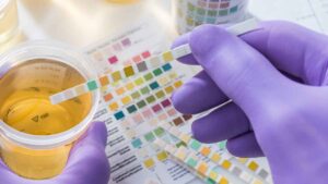 Una empresa despide tras 27 años a un trabajador por dar positivo en un test: “Soy bipolar, es parte del tratamiento”