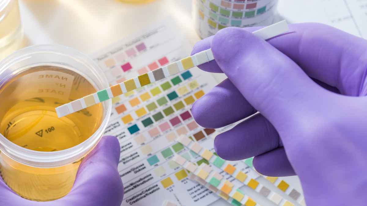 Test de orina utilizado en un control interno para detectar consumo de sustancias en el ámbito laboral
