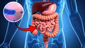 Sanidad pide no consumir este famoso queso por riesgo de infección de la toxina Shiga