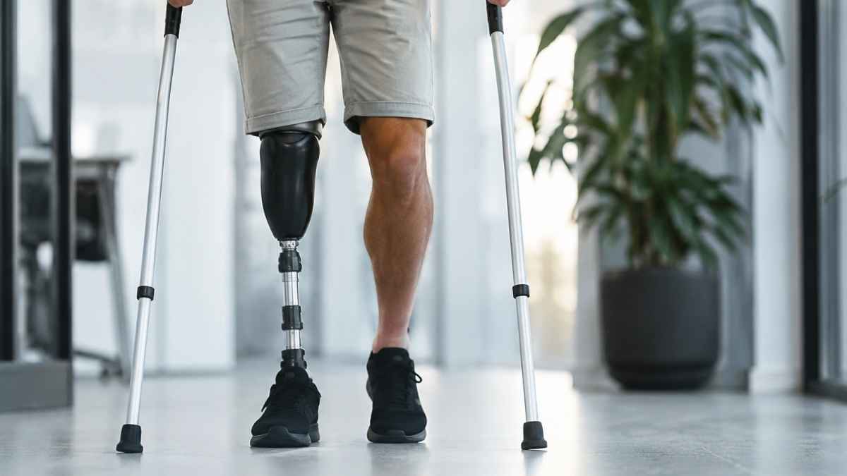 Trabajador con prótesis en una pierna y muletas tras sufrir una amputación por accidente laboral