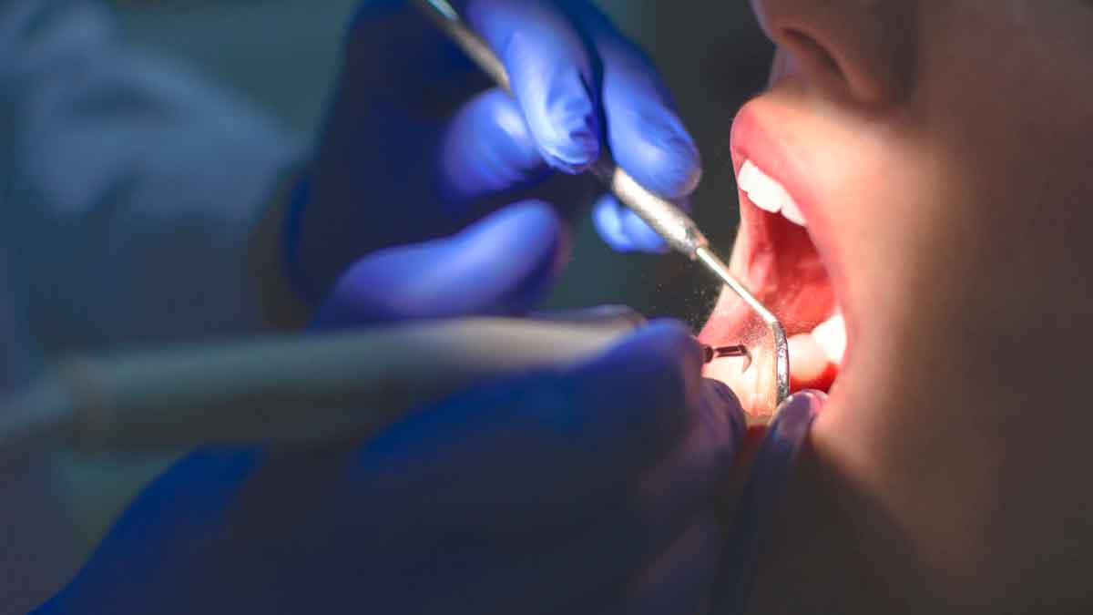 Podrás ir al dentista gratis al 2025 si cumples estos requisitos